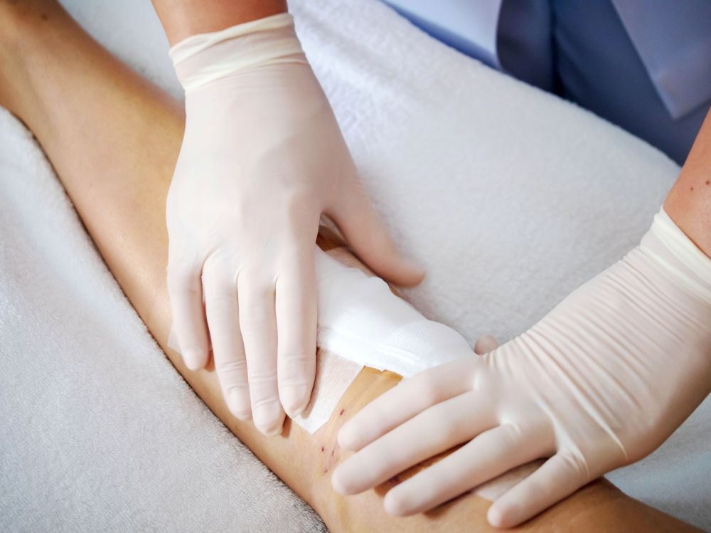 Post-surgery dressing care